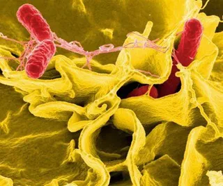 Salmonella. Foto: EP