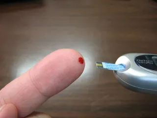 Prueba de la diabetes | Europa Press