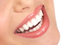 Dientes blancos