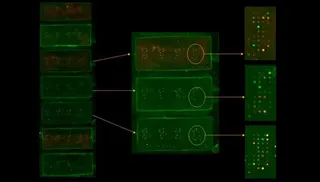 Chip diseñado en el Centro de Investigación del Cáncer (USAL-CSIC)