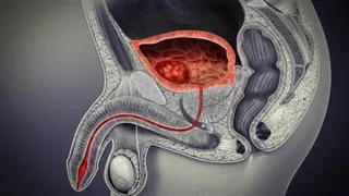 Infosalus