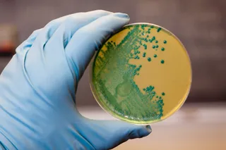 Archivo - Imagen de 'Listeria'.