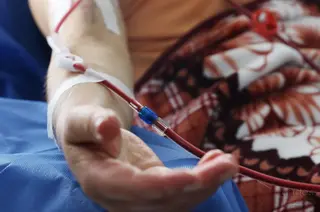 La enfermedad renal crónica
